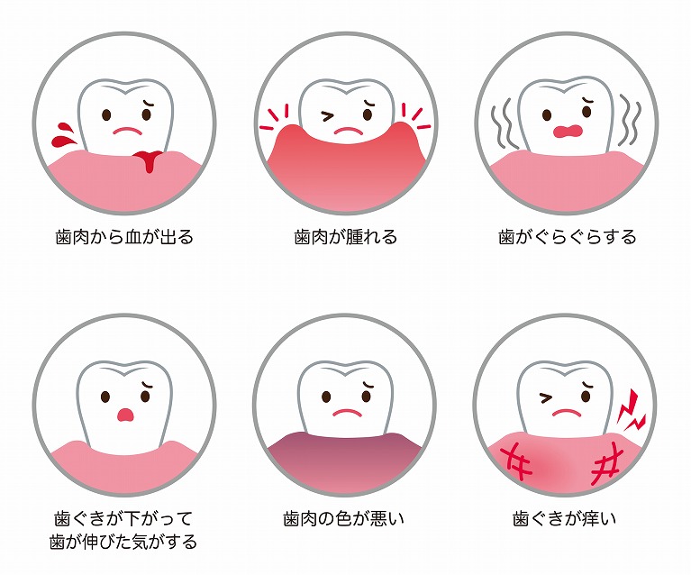 鎌倉市で歯周病治療は歯周検査や唾液検査のある歯医者 グリーン歯科 鎌倉市で歯周病治療は歯周検査や唾液検査のある歯医者 グリーン歯科